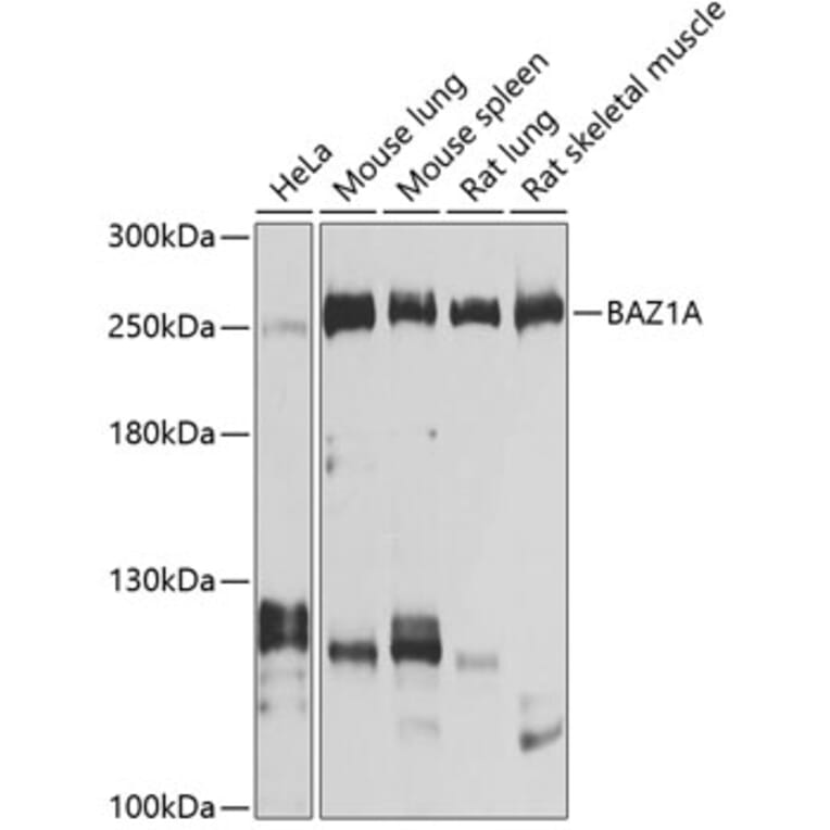 Western Blot - Anti-ACF1/BAZ1A Antibody (A16358) - Antibodies.com