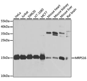 Western Blot - Anti-MRPS16 Antibody (A9874) - Antibodies.com