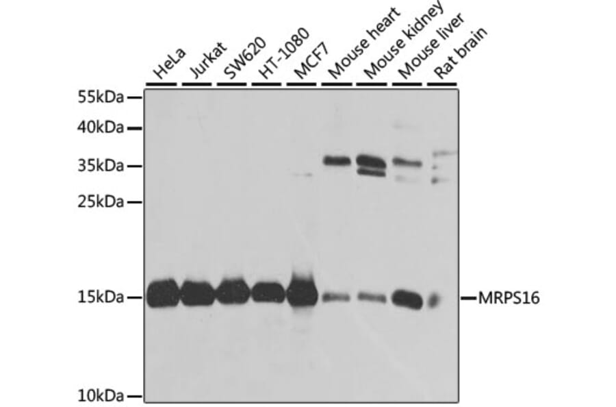 Western Blot - Anti-MRPS16 Antibody (A9874) - Antibodies.com