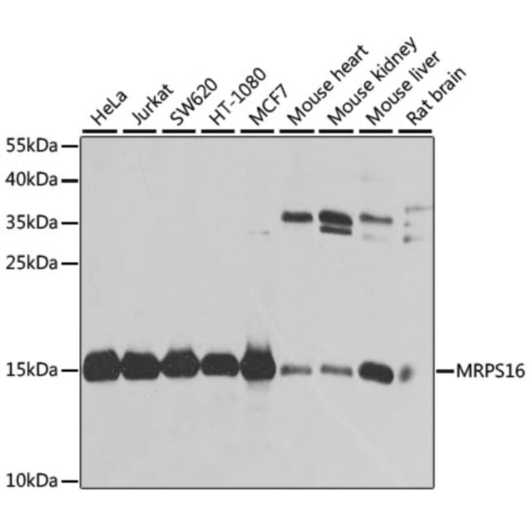 Western Blot - Anti-MRPS16 Antibody (A9874) - Antibodies.com
