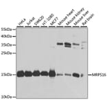 Western Blot - Anti-MRPS16 Antibody (A9874) - Antibodies.com