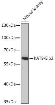 Western blot analysis of extracts of various cell lines, using Anti-ELP3 Antibody (A9877) at 1:1,000 dilution.
Secondary antibody: Goat Anti-Rabbit IgG (H+L) (HRP) (AS014) at 1:10,000 dilution.
Lysates / proteins: 25µg per lane.
Blocking buffer: 3% non-fat dry milk in TBST.
Detection: ECL Basic Kit (RM00020).
Exposure time: 10s.