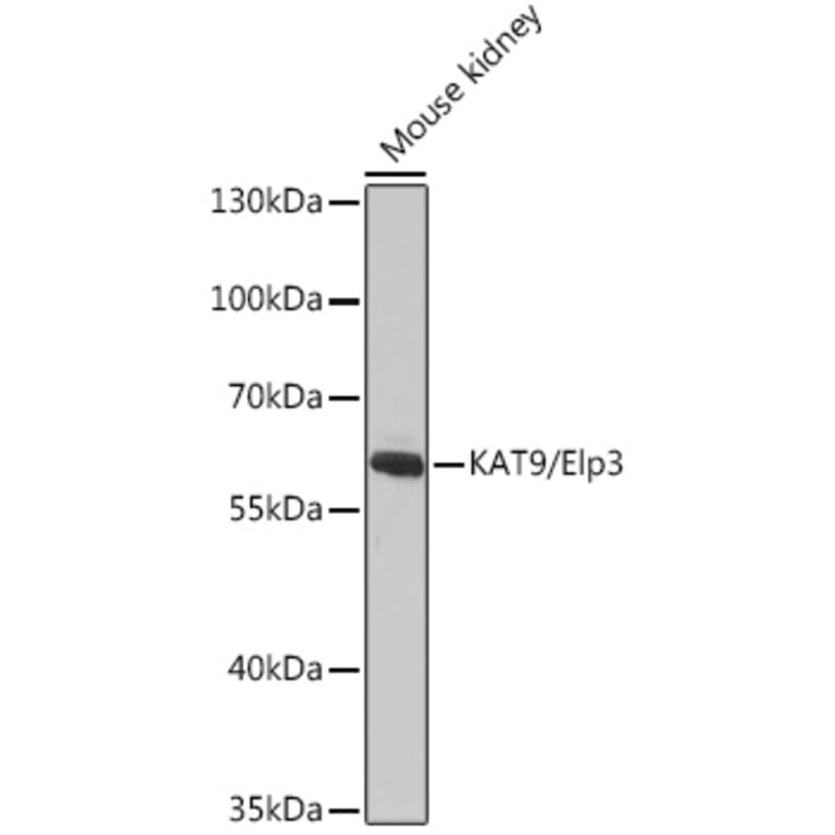 Western Blot - Anti-KAT9/Elp3 Antibody (A16360) - Antibodies.com