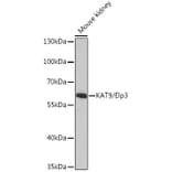 Western Blot - Anti-KAT9/Elp3 Antibody (A16360) - Antibodies.com