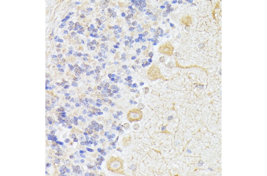 Immunohistochemistry - Anti-KAT9/Elp3 Antibody (A16360) - Antibodies.com