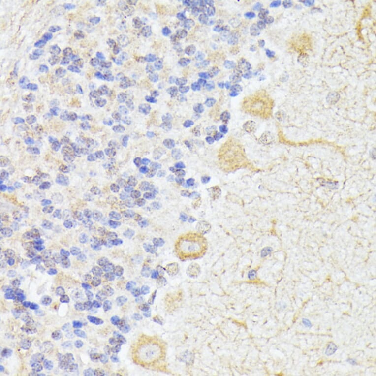 Immunohistochemistry - Anti-KAT9/Elp3 Antibody (A16360) - Antibodies.com