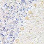 Immunohistochemistry - Anti-KAT9/Elp3 Antibody (A16360) - Antibodies.com