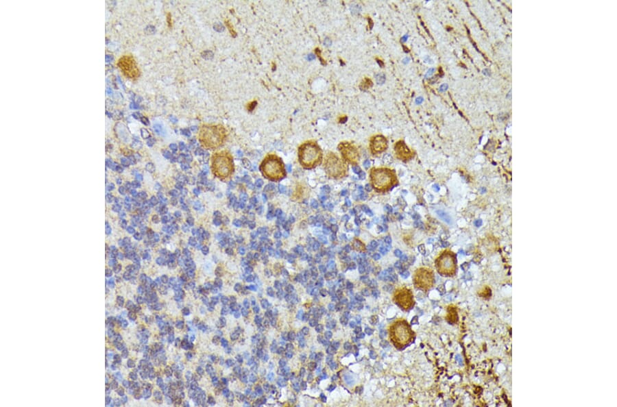 Immunohistochemistry - Anti-KAT9/Elp3 Antibody (A16360) - Antibodies.com