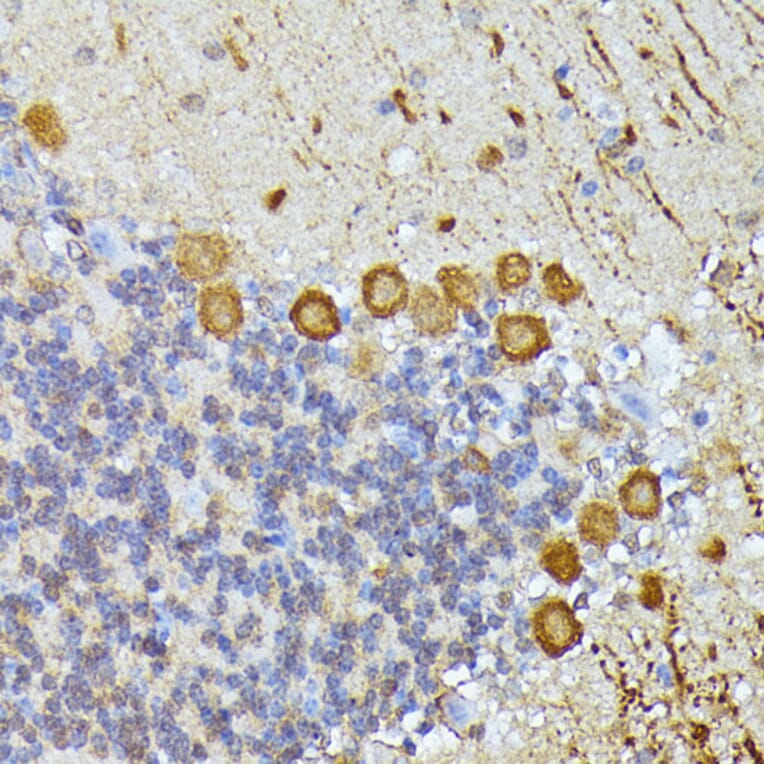 Immunohistochemistry - Anti-KAT9/Elp3 Antibody (A16360) - Antibodies.com
