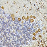 Immunohistochemistry - Anti-KAT9/Elp3 Antibody (A16360) - Antibodies.com