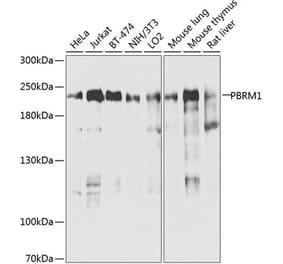 Western Blot - Anti-Baf180 Antibody (A16361) - Antibodies.com