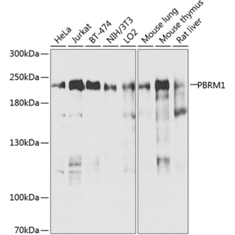 Western Blot - Anti-Baf180 Antibody (A16361) - Antibodies.com