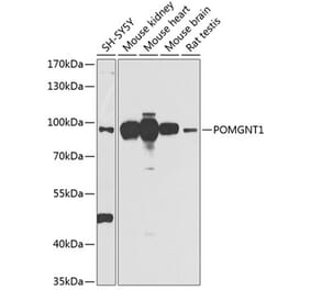 Western Blot - Anti-POMGNT1 Antibody (A16362) - Antibodies.com