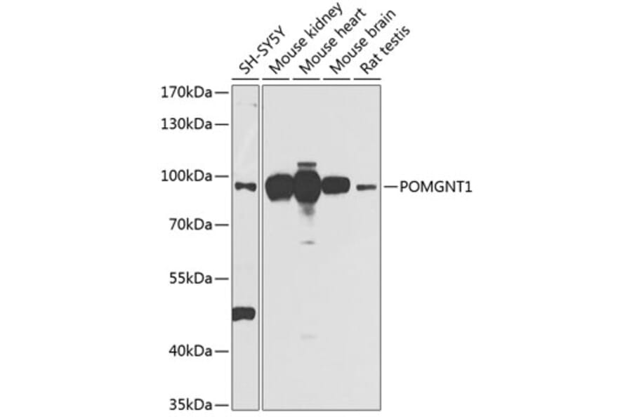 Western Blot - Anti-POMGNT1 Antibody (A16362) - Antibodies.com