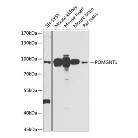 Western Blot - Anti-POMGNT1 Antibody (A16362) - Antibodies.com