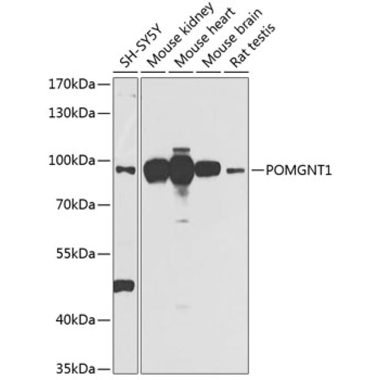 Western Blot - Anti-POMGNT1 Antibody (A16362) - Antibodies.com