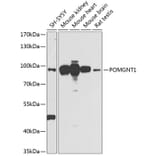 Western Blot - Anti-POMGNT1 Antibody (A16362) - Antibodies.com