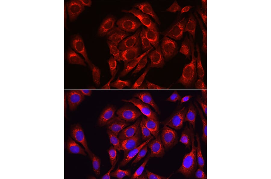 Immunofluorescence - Anti-Mitofusin 1 Antibody (A16363) - Antibodies.com