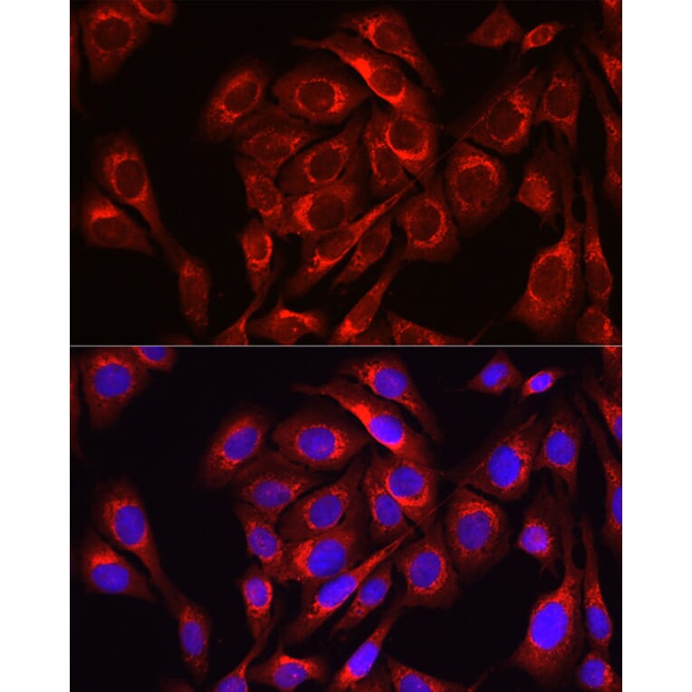 Immunofluorescence - Anti-Mitofusin 1 Antibody (A16363) - Antibodies.com