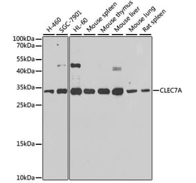 Western Blot - Anti-Dectin-1 Antibody (A16364) - Antibodies.com