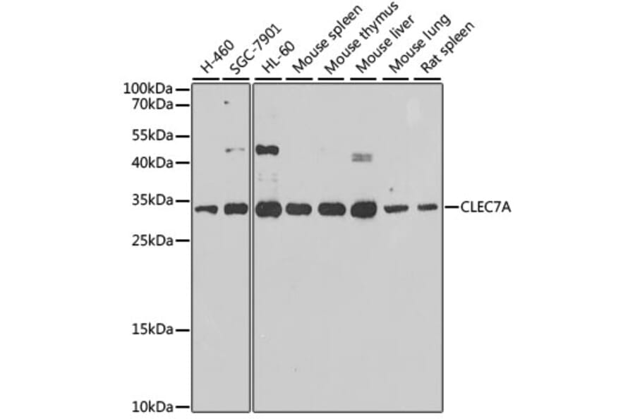 Western Blot - Anti-Dectin-1 Antibody (A16364) - Antibodies.com