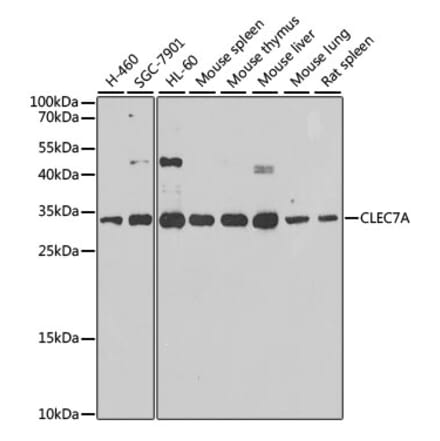 Western Blot - Anti-Dectin-1 Antibody (A16364) - Antibodies.com