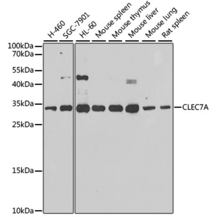 Western Blot - Anti-Dectin-1 Antibody (A16364) - Antibodies.com