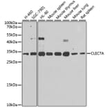 Western Blot - Anti-Dectin-1 Antibody (A16364) - Antibodies.com