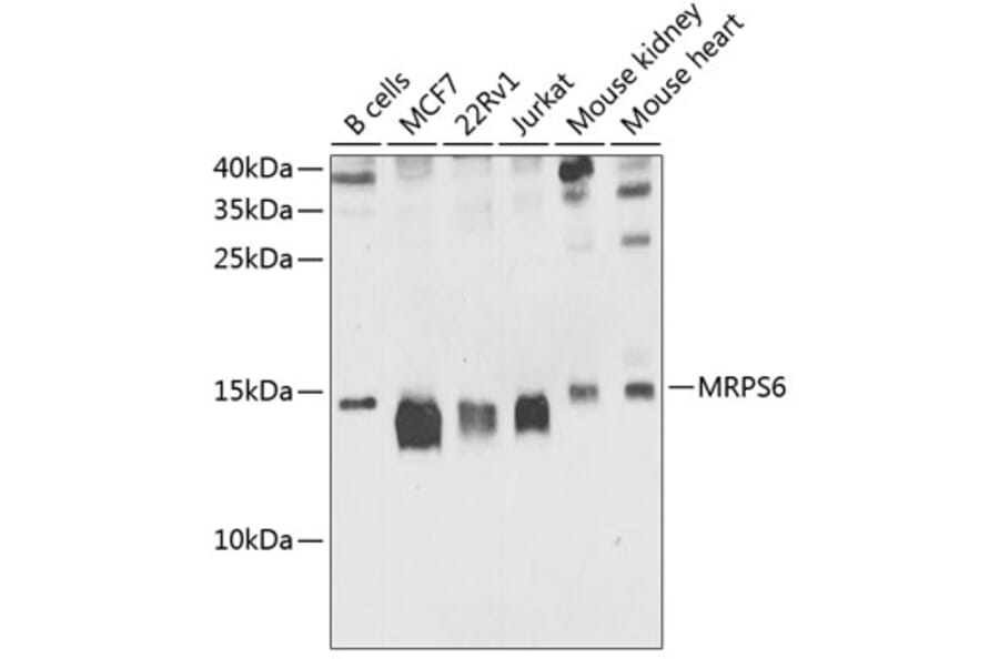 Western Blot - Anti-MRPS6 Antibody (A16365) - Antibodies.com
