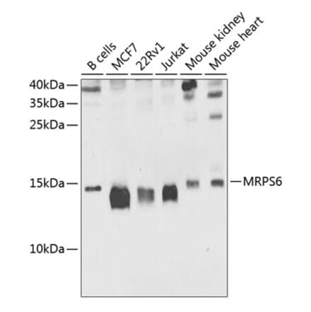 Western Blot - Anti-MRPS6 Antibody (A16365) - Antibodies.com