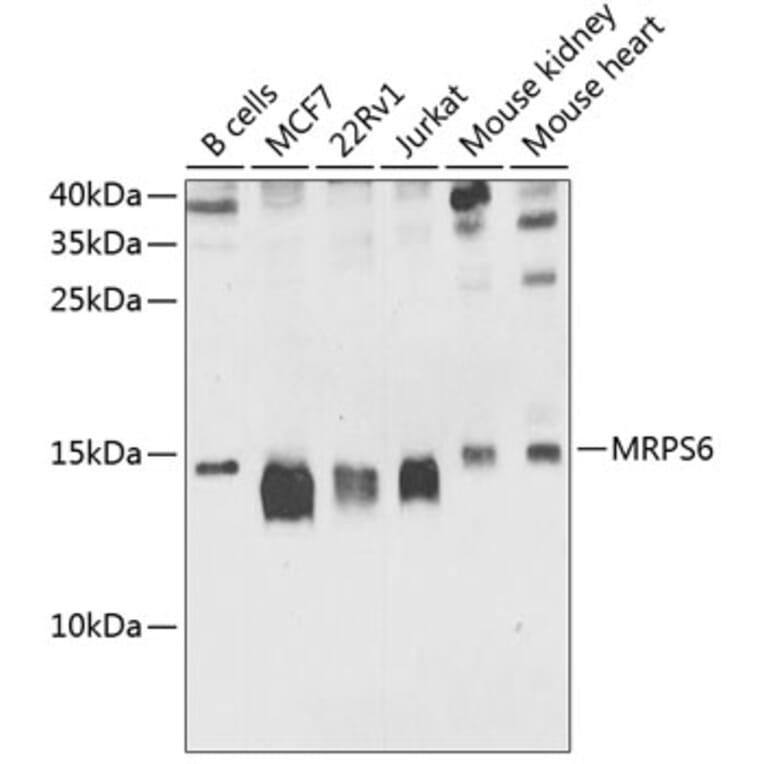 Western Blot - Anti-MRPS6 Antibody (A16365) - Antibodies.com