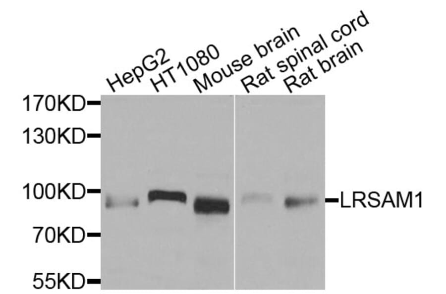 Western Blot - Anti-LRSAM1 Antibody (A9885) - Antibodies.com