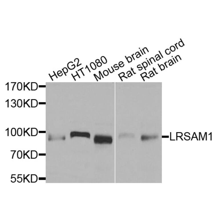 Western Blot - Anti-LRSAM1 Antibody (A9885) - Antibodies.com