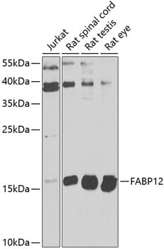 Western blot analysis of extracts of various cell lines, using Anti-FABP12 Antibody (A9894) at 1:1,000 dilution.
Secondary antibody: Goat Anti-Rabbit IgG (H+L) (HRP) (AS014) at 1:10,000 dilution.
Lysates / proteins: 25µg per lane.
Blocking buffer: 3% non-fat dry milk in TBST.
Detection: ECL Basic Kit (RM00020).
Exposure time: 30s.