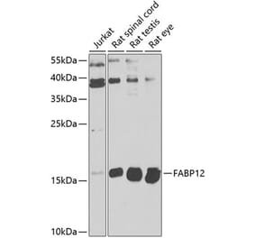 Western Blot - Anti-FABP12 Antibody (A16367) - Antibodies.com