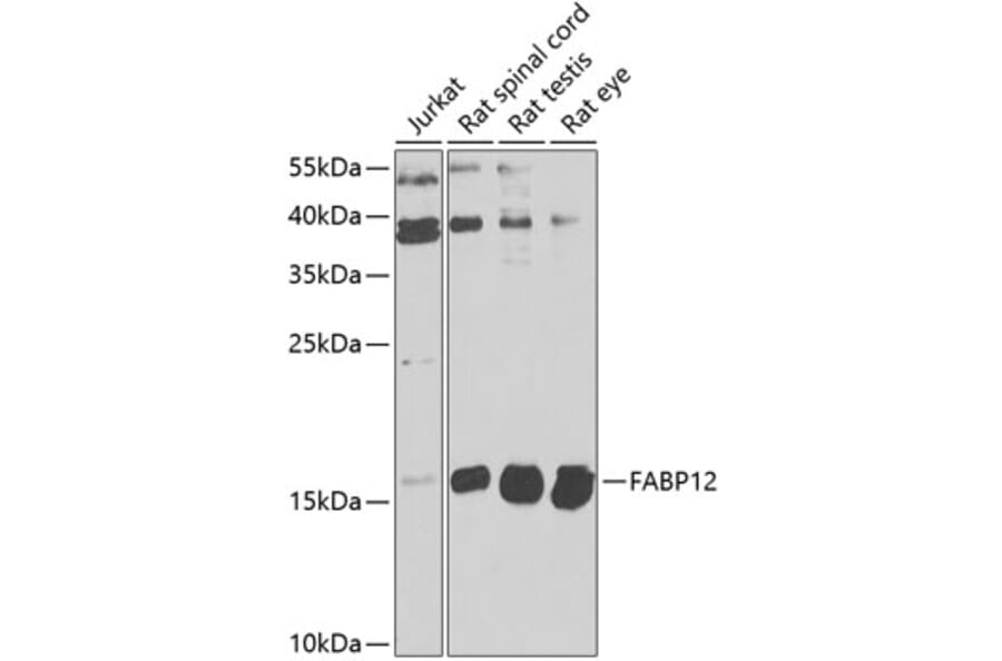 Western Blot - Anti-FABP12 Antibody (A9894) - Antibodies.com