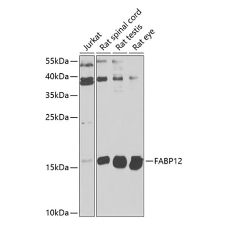 Western Blot - Anti-FABP12 Antibody (A16367) - Antibodies.com