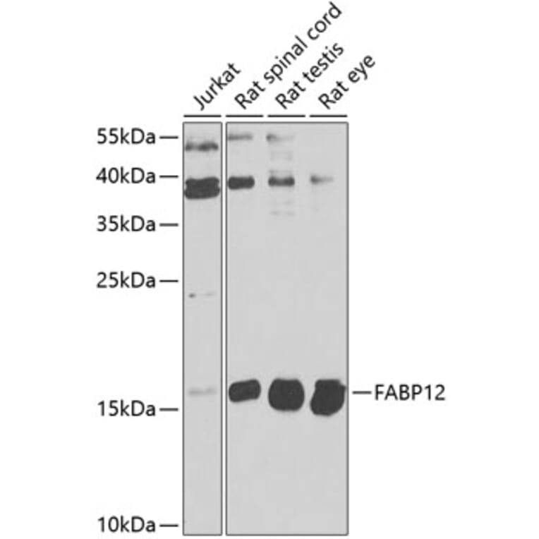 Western Blot - Anti-FABP12 Antibody (A9894) - Antibodies.com