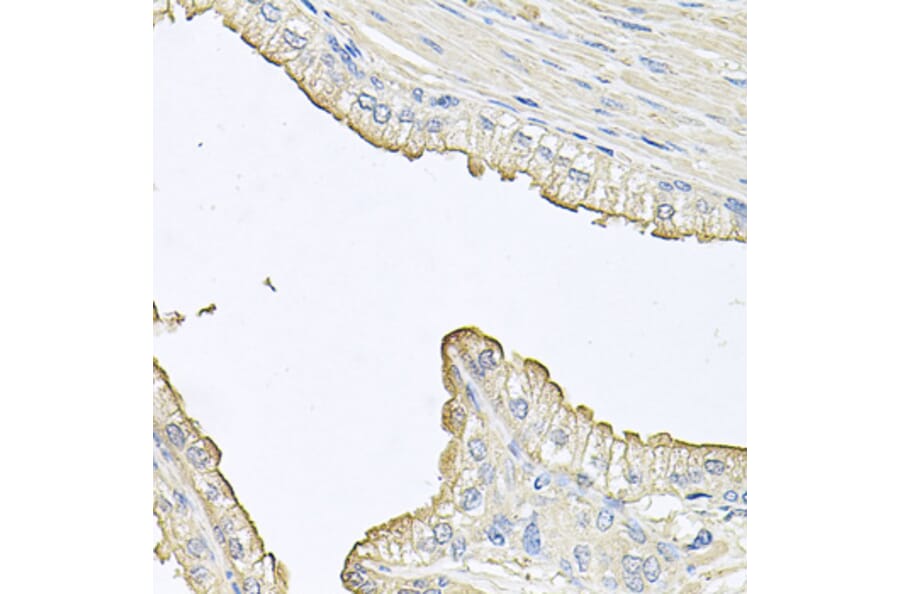 Immunohistochemistry - Anti-FABP12 Antibody (A9894) - Antibodies.com