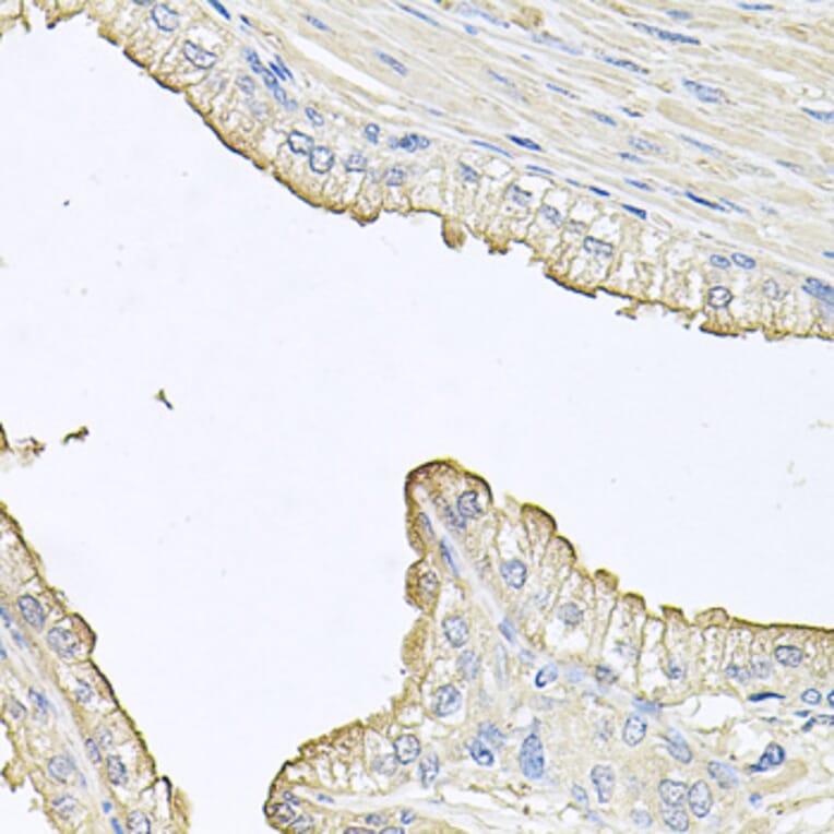 Immunohistochemistry - Anti-FABP12 Antibody (A9894) - Antibodies.com