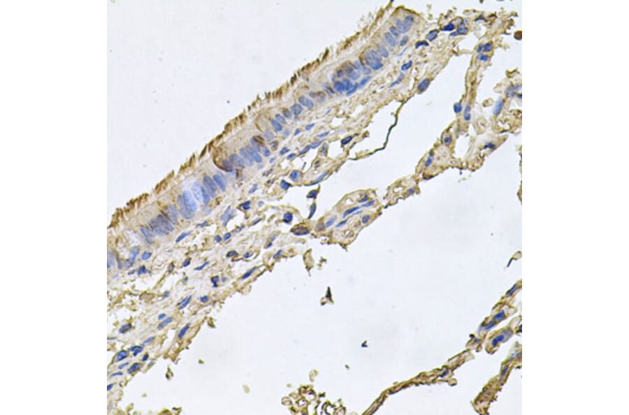 Immunohistochemistry - Anti-FABP12 Antibody (A9894) - Antibodies.com