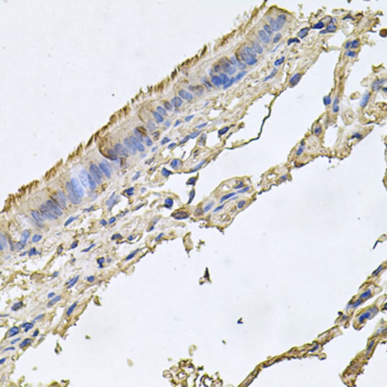 Immunohistochemistry - Anti-FABP12 Antibody (A9894) - Antibodies.com