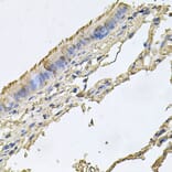 Immunohistochemistry - Anti-FABP12 Antibody (A9894) - Antibodies.com