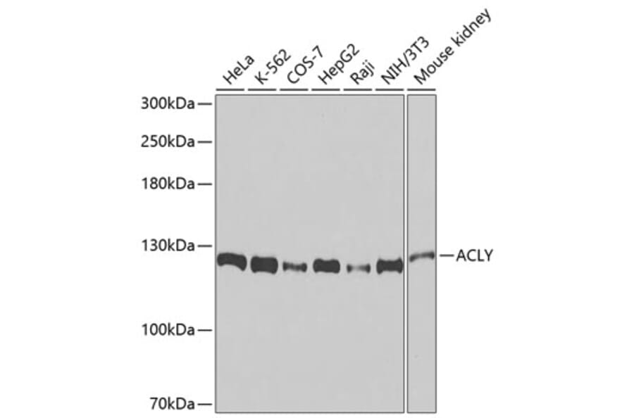 Western Blot - Anti-ACLY Antibody (A9901) - Antibodies.com