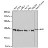 Western Blot - Anti-ACLY Antibody (A9901) - Antibodies.com