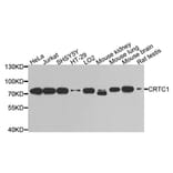 Western Blot - Anti-CRTC1 Antibody (A9918) - Antibodies.com
