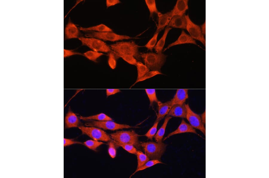 Immunofluorescence - Anti-AMT Antibody (A16372) - Antibodies.com