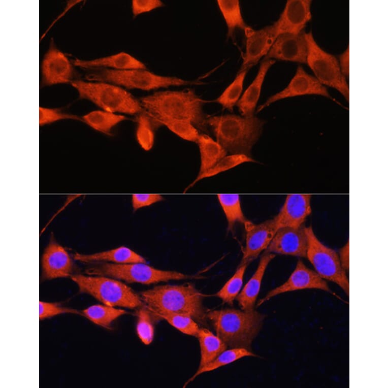 Immunofluorescence - Anti-AMT Antibody (A16372) - Antibodies.com