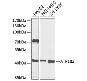 Western Blot - Anti-ATP1B2 Antibody (A16373) - Antibodies.com