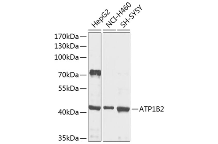 Western Blot - Anti-ATP1B2 Antibody (A16373) - Antibodies.com